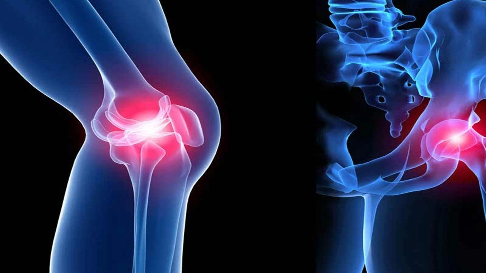 Η συνταγή θαύμα: Μπορεί να θεραπεύσει τους πόνους στις αρθρώσεις σας σε 7 μόλις μέρες